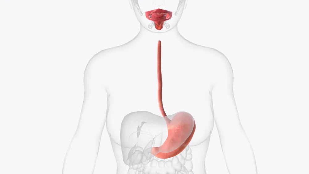 Cáncer de esófago en Guadalajara